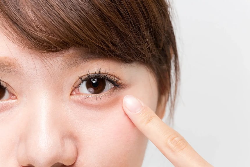 A woman points to her droopy eyelids