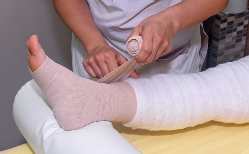 Close-up of a healthcare professional applying compression bandages on a patient’s leg during lymphedema treatment in Singapore