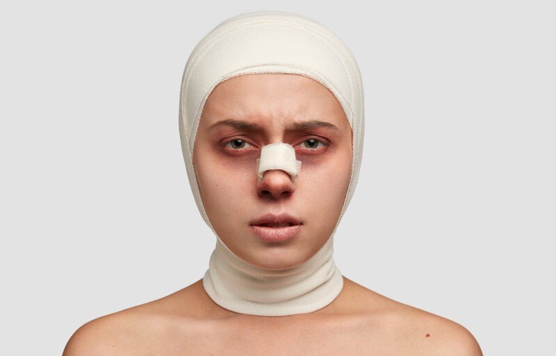 Facial Plastic Surgery