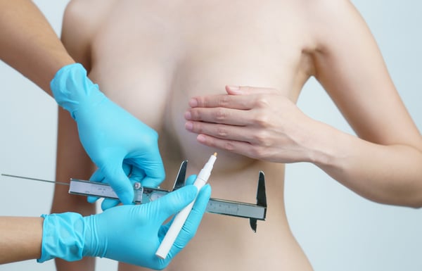 Breast Reduction-1