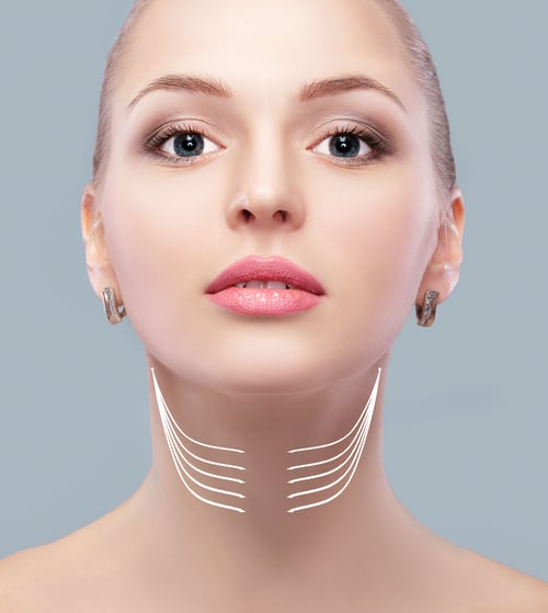 Necklift