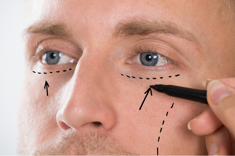 aesthetic procedures for men
