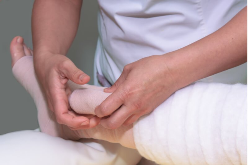 compression garment lymphedema