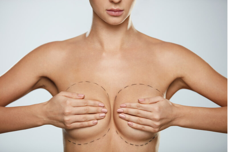 natural looking breast augmentation results