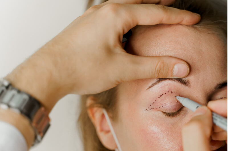 ptosis surgery assessment and consultation