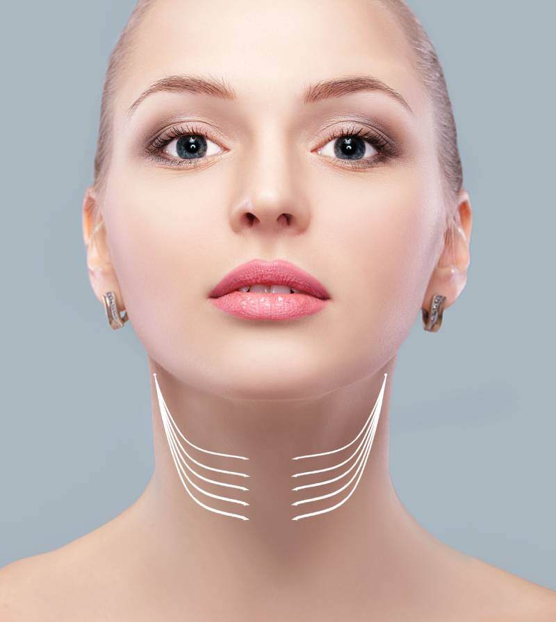 Necklift