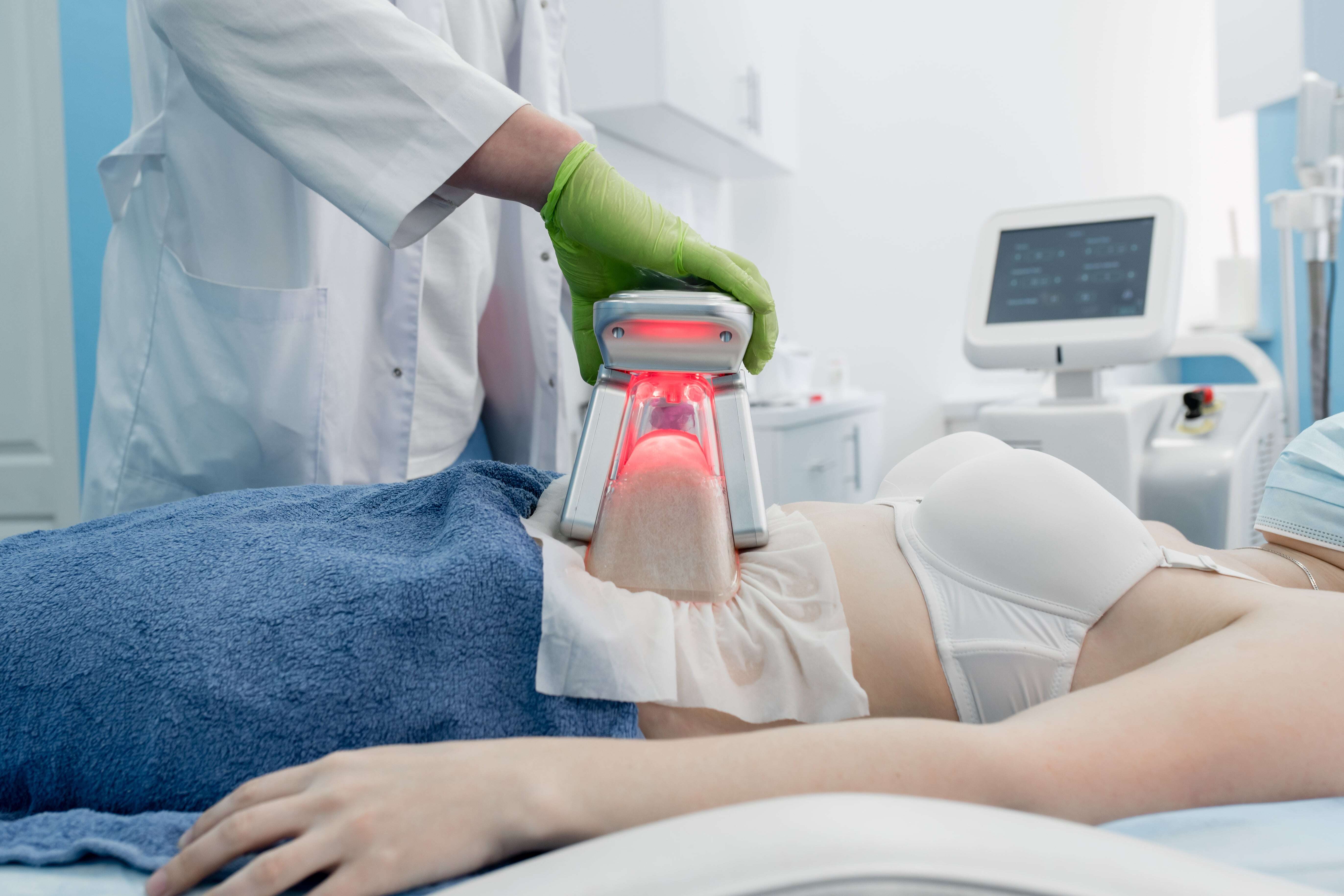 Patient undergoing Fat Freezing procedure