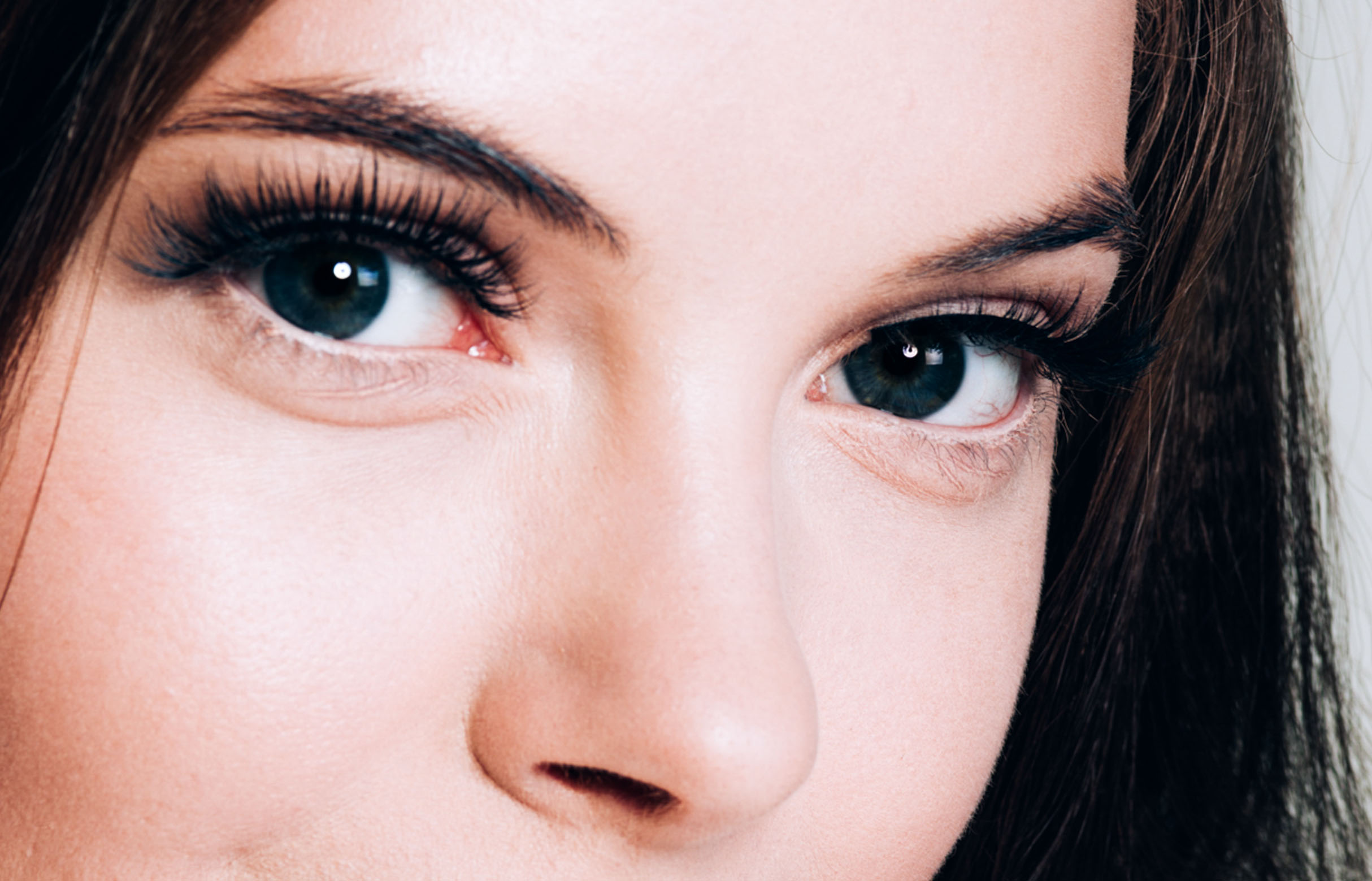 Lower Eyelid Surgery
