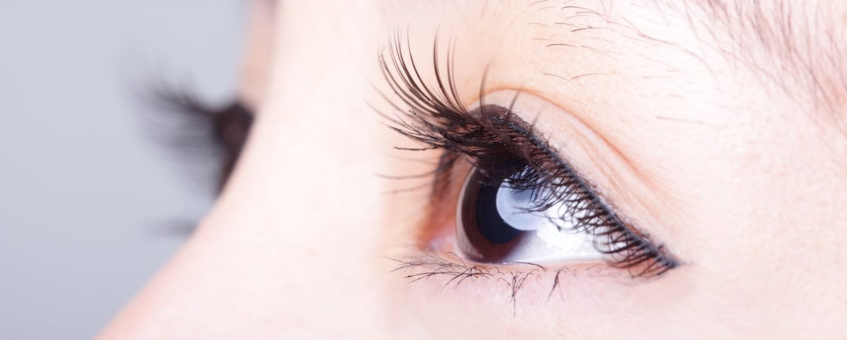 Upper Eyelid Surgery